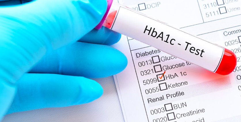 HbA1c Test