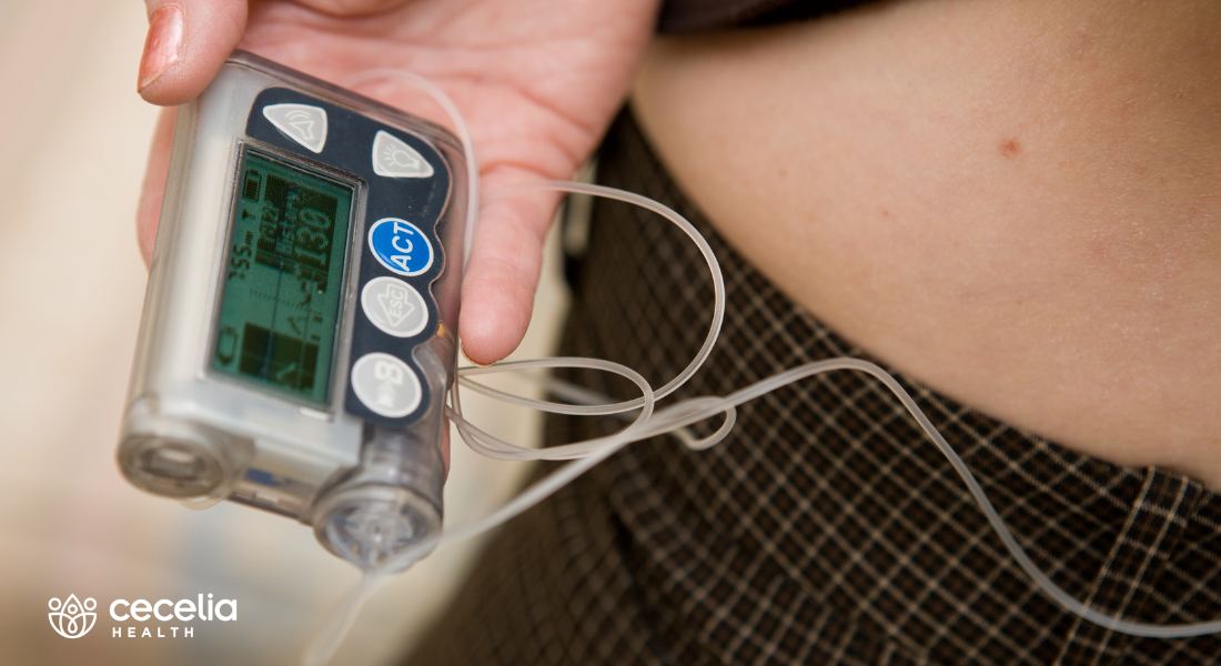 close up of insulin pump with tubing